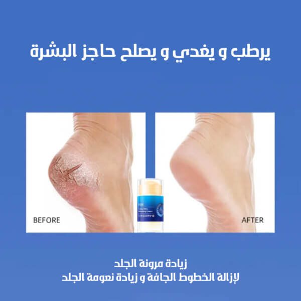 ⁦ستيك مرطب لليدين والقدمين- أزرق⁩ - الصورة ⁦2⁩